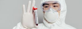 Od 16 maja 2022 r. obowiązujący stan epidemii został zastąpiony stanem zagrożenia epidemicznego